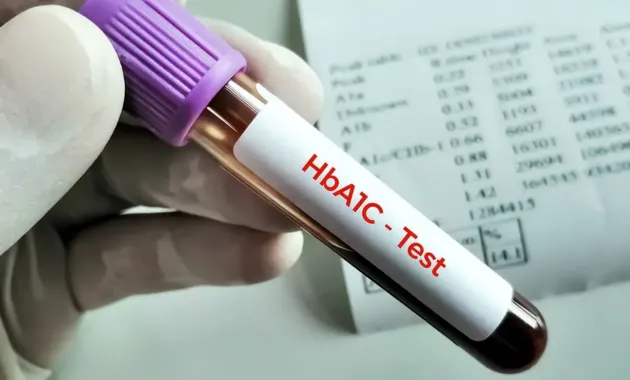 HbA1c (Diabetes Control Test)