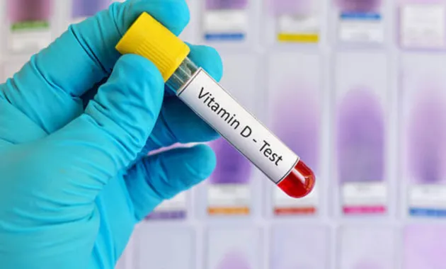 Vitamin D3 Test